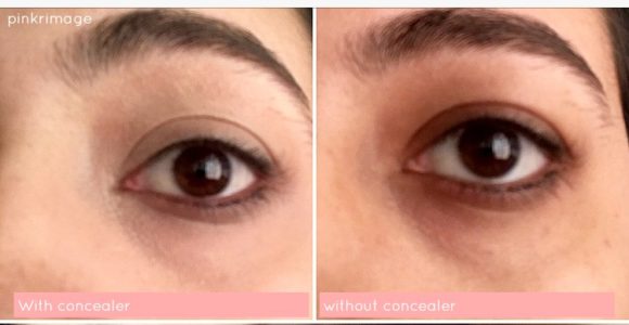 best under eye concealer for dark circles